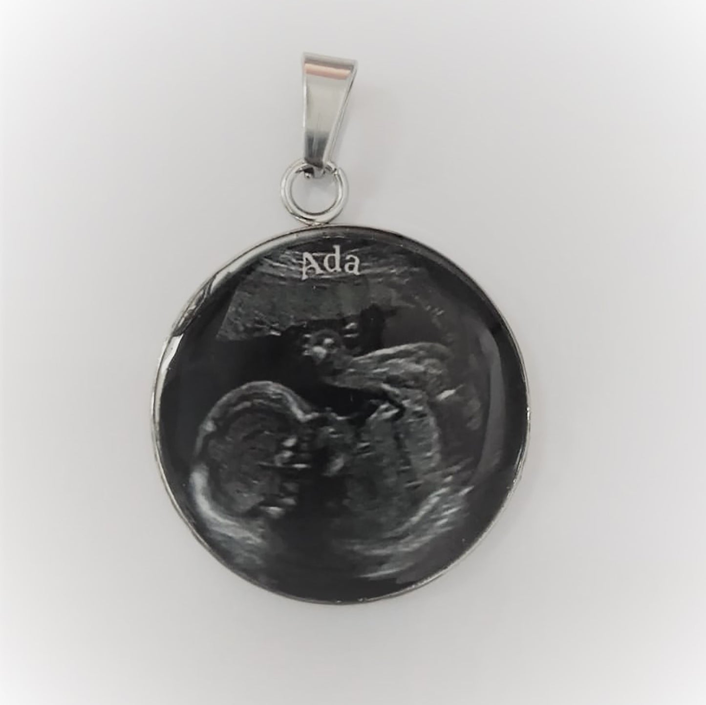 Ultrasound Scan Pendant