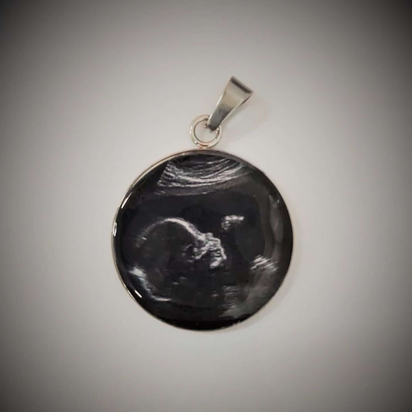 Ultrasound Scan Pendant